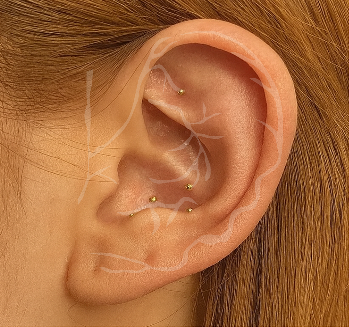 Close-up of a person's ear with gold acupressure ear seeds